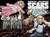 Scars