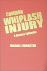 Common Whiplash Injury: A Modern Epidemic