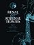 Renal and Adrenal Tumors: Biology and Management