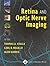 Retina and Optic Nerve Imaging