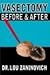 Vasectomy - Before and After