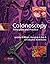Colonoscopy by Jerome D. Wayne