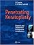 Penetrating Keratoplasty: Diagnosis and Treatment of Postoperative Complications