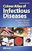 Colour Atlas of Infectious Diseases