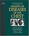 Imaging of Diseases of the Chest: Expert Consult - Online and Print