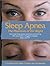 Sleep Apnea - The Phantom of the Night: Overcome sleep apnea syndrome and snoring