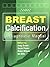 Breast Calcification: A Dia...