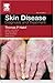 Skin Disease by Thomas P. Habif