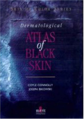 Dermatological Atlas of Black Skin (Hardcover)