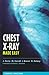 Chest X-Ray Made Easy by Mary Carroll
