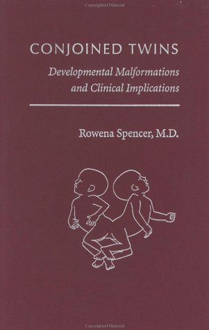 Conjoined Twins: Developmental Malformations and Clinical Implications (Hardcover)