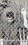 Beautiful Retard