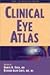 Clinical Eye Atlas