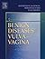 Benign Diseases of the Vulva and Vagina
