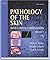Pathology of the Skin: With Clinical Correlations (2 Volume Set)