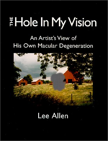 The Hole in My Vision (Paperback)