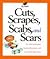 Cuts, Scrapes, Scabs, and Scars