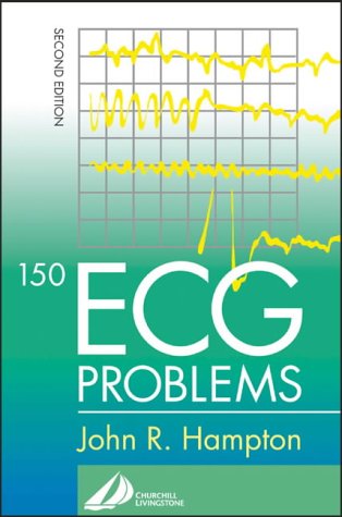 150 ECG Problems (Paperback)