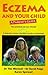 Eczema and Your Child