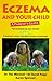 Eczema and Your Child by Tim Mitchell