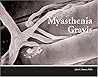 Myasthenia Gravis by John C. Keesey Myasthenia Gravis by John C. Keesey