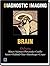 Diagnostic Imaging: Brain