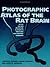 Photographic Atlas of the Rat Brain by Lawrence Kruger