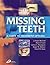 Missing Teeth: A Guide to Treatment Options