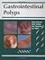 Gastrointestinal Polyps