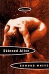 Skinned Alive: St...