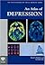 An Atlas of Depression (Encyclopedia of Visual Medicine Series)