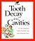 Tooth Decay and Cavities