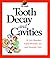 Tooth Decay and Cavities (My Health)