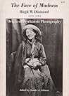 The Face of Madness: Hugh W. Diamond and the Origin of Psychiatric Photography The Face of Madness: Hugh W. Diamond and the Origin of Psychiatric Photography