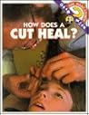 How Does a Cut Heal? (Ask Isaac Asimov)
