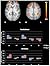 The Neural Correlates of Religious and Nonreligious Belief by Sam Harris