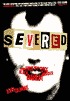 Severed: The True...