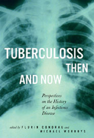 Tuberculosis Then and Now: Perspectives on the History of an Infectious Disease (McGill-Queen's/AMS Healthcare Studies in the History of Medicine, Health, and Society, 37) (Volume 36)