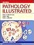Pathology Illustrated