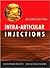 Intra-Articular Injections