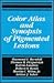 Color Atlas and Synopsis of Pigmented Lesions: The Pigmented Lesion Clinic, Massachusetts General Hospital : A Perspective of Three Decades, 1965-19