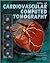 Atlas of Cardiovascular Computed Tomography