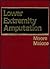 Lower Extremity Amputation