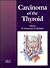 Carcinoma of the Thyroid by J.T. Johnson