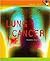 Lung Cancer (Health Alert)