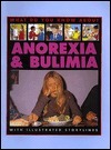 Anorexia and Bulimia