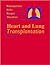 Heart and Lung Transplantation