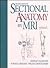 Sectional Anatomy By MRI