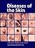 Diseases of the Skin: A Col...