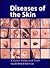 Diseases of the Skin by Gary M. White